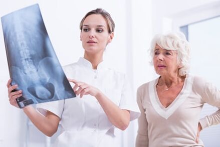 X-ray examination is an informative way to diagnose osteochondrosis of the spine. 