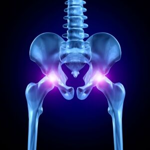 Pain in the hip joints can be acute, painful or chronic. 