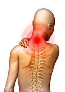 Pain is the main symptom of cervical osteochondrosis.