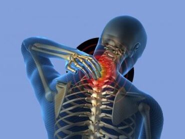 A person with osteochondrosis of the cervical spine is bothered by neck pain.