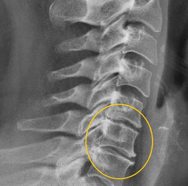 Diagnostic image